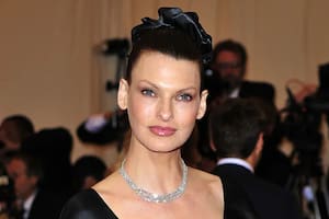 Linda Evangelista alcanza un acuerdo con la empresa cosmética que la dejó "permanentemente deformada". (Crédito: gtresonline)