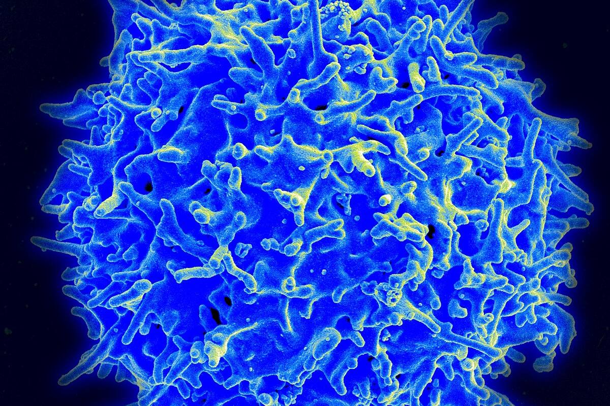 Linfocito T, una célula del sistema inmune que los investigadores lograron modificar