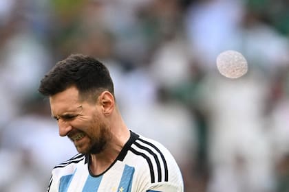 Lionel Messi y todo el dolor en su cara