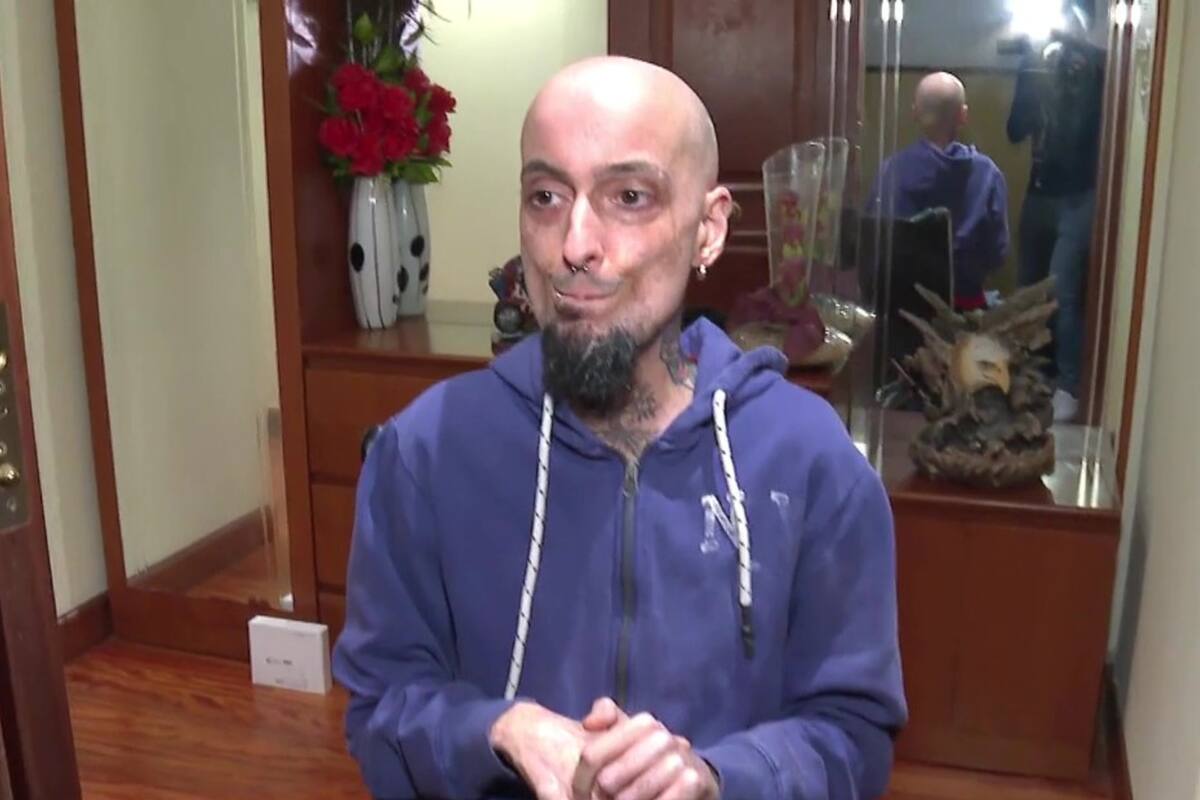 Lleva 18 años encerrado en su departamento del tercer piso e inició una colecta que cambiará su vida