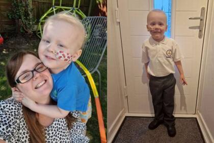 Llevó a su hijo al médico por una supuesta alergia y el diagnóstico la devastó: “Fue aterrador”