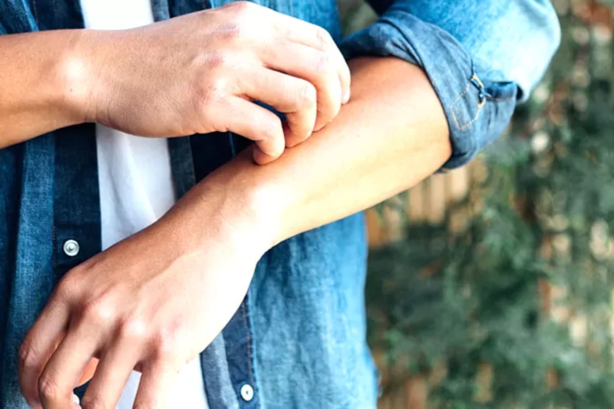 Lo primero que debés preguntarte es: ¿crees que podría haber estado expuesto?