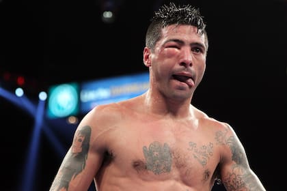 Lo que está entre las dos hinchazones es el ojo derecho de Lucas Matthysse.