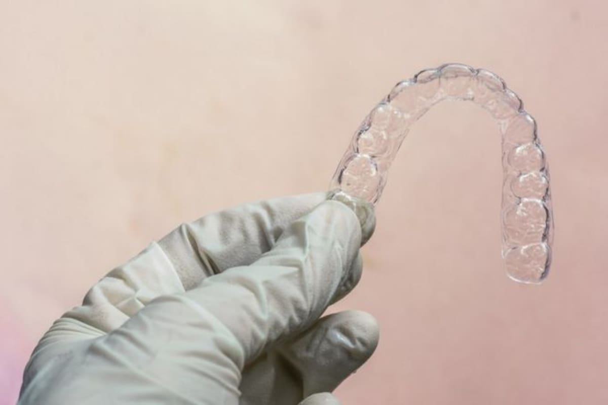 Lo que preocupa a los dentistas es que la gente que compra tratamientos por internet puede que no sea consciente de los riesgos que corre.