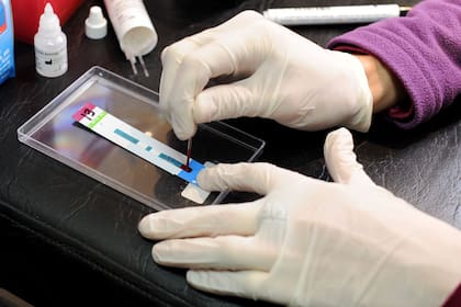 Logran curar a un paciente con VIH por segunda vez en la historia