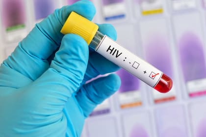 Lograr la curación de determinados pacientes supone un gran hito científico en la lucha contra el VIH