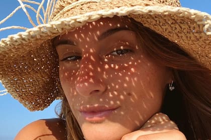Lola Latorre habló de sus problemas de acné con su comunidad de Instagram