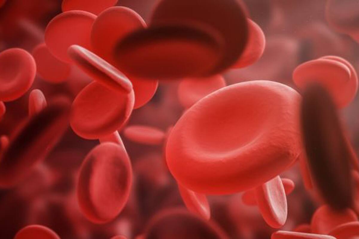 Los alimentos con alto contenido de hierro pueden ayudar a quienes tengan anemia