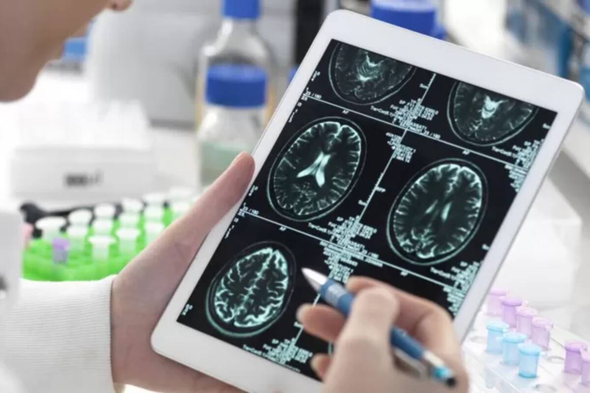 Los autores del trabajo no saben si estos daños son provocados por el virus en sí o son consecuencia de la enfermedad