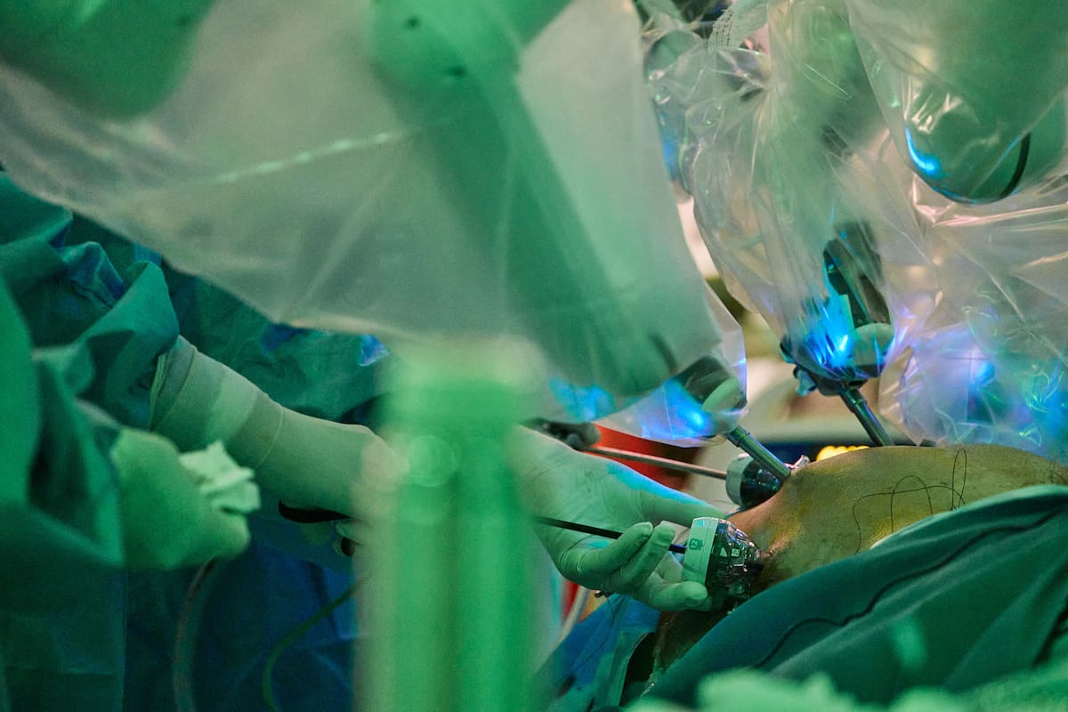 Los brazos del robot Da Vinci sobre el abdomen de un paciente oncológico