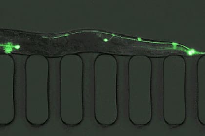 Los C. elegans producen más de 1.000 huevos al día, se pueden cultivar en grandes cantidades y los cultivos sanos se pueden congelar y luego descongelar y revivir cuando sea necesario