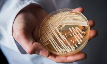 Los casos clínicos de Candida auris pueden ser difíciles de diagnosticar