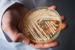 Los casos clínicos de Candida auris, un hongo emergente considerado una amenaza urgente, aumentaron considerablemente en los últimos años
