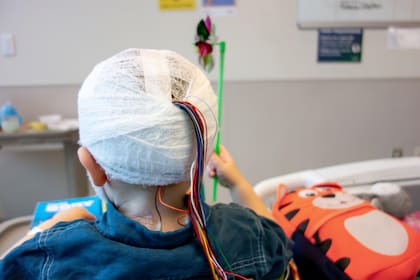 Los científicos creen que la estimulación cerebral profunda puede ayudar a tratar casos muy serios de epilepsia.