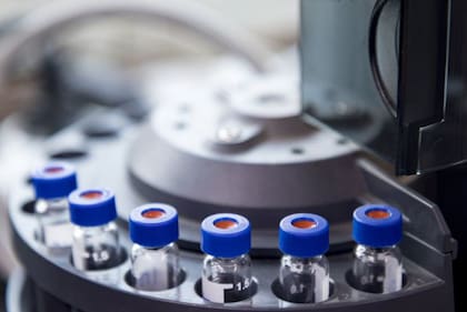 Los científicos investigan si las pruebas de laboratorio de muestras de sangre pueden servir para diagnosticar la enfermedad de Alzheimer