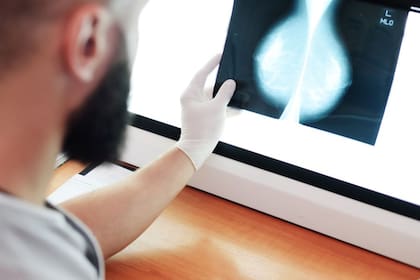 Los controles periódicos son elementales para la prevención del cáncer de mama