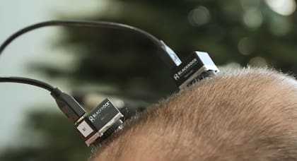 Los desarrollos más recientes exploran implantes capaces de registrar señales neuronales y transformarlas en palabras mediante inteligencia artificial
