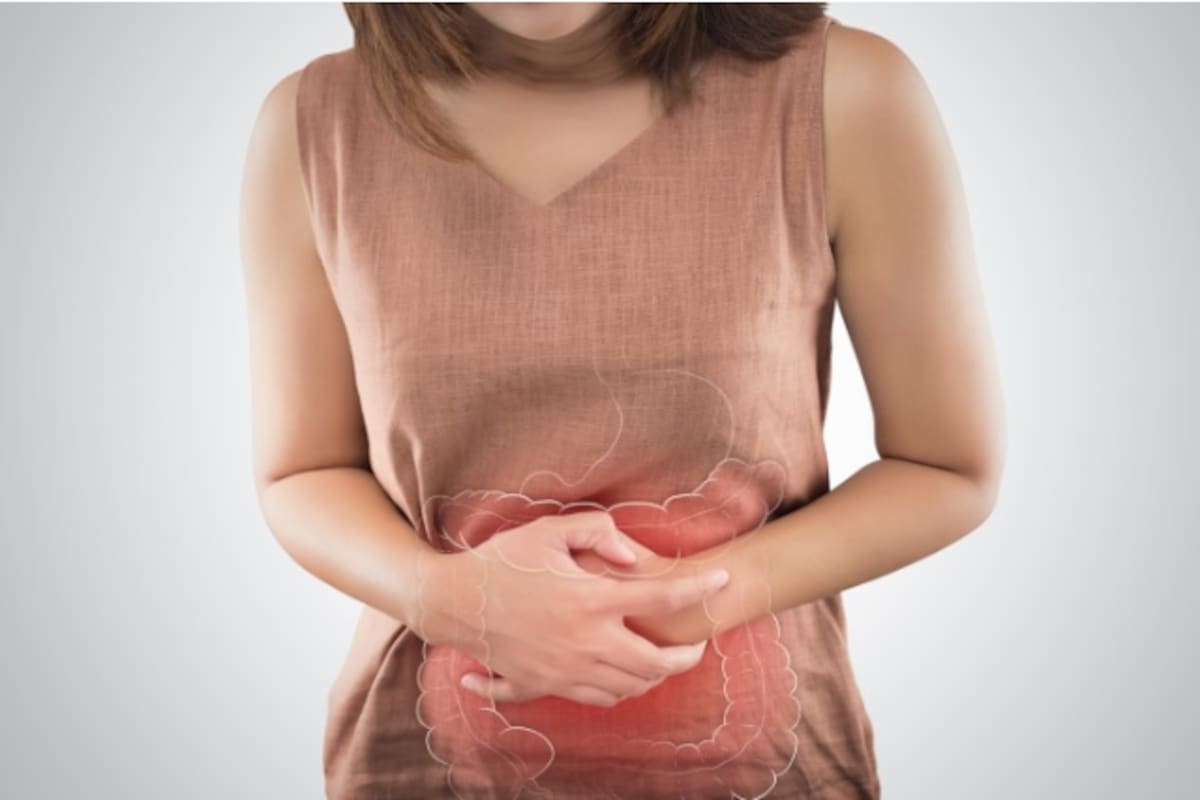 Los divertículos son pequeñas bolsas o sacos que se forman en la pared del intestino