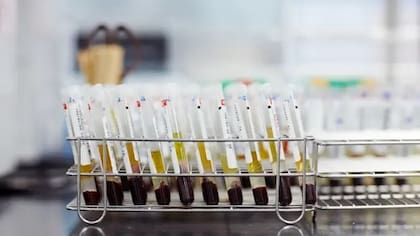 Los donantes se someten a estrictos controles, que incluyen análisis de sangre y heces para detectar patógenos
