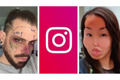 Los efectos que tengan relación con cirugías extremas serán vetados dentro de la aplicación de fotografía y video digital de Facebook