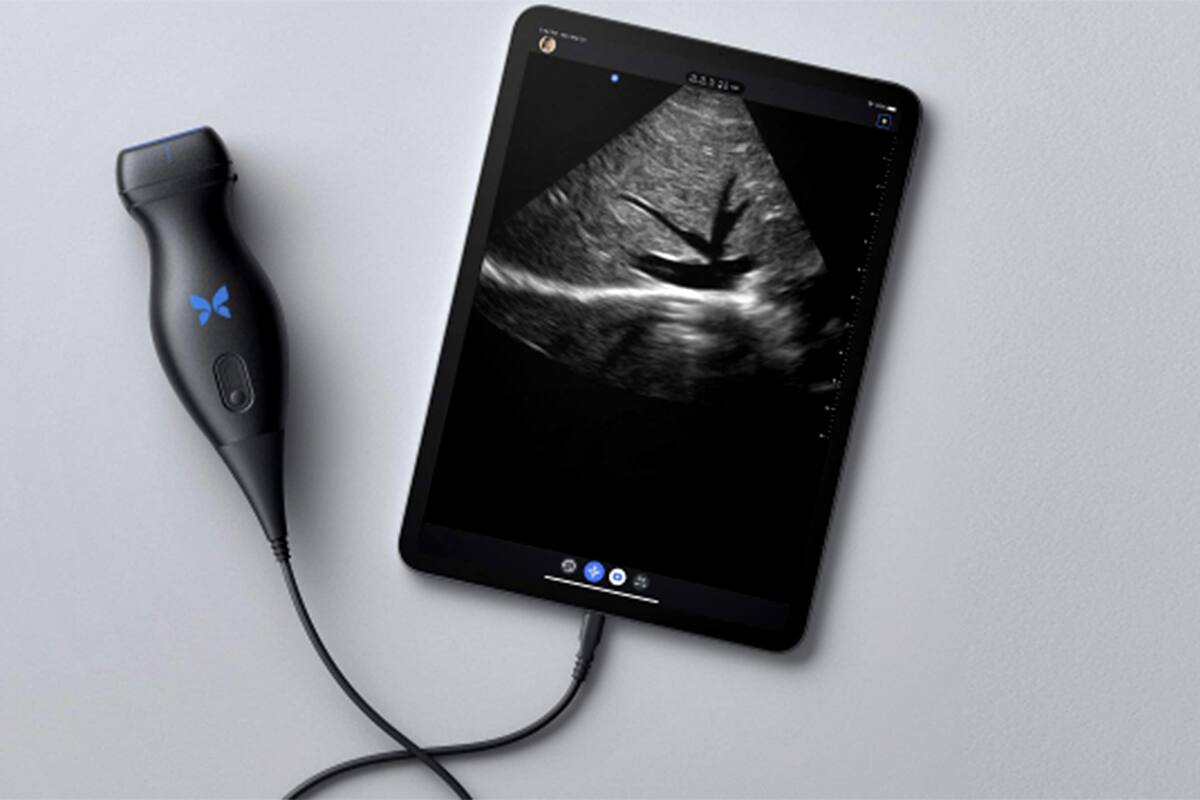 Los equipos de ultrasonidos portátiles Butterfly iQ donados por la empresa Unitec Blue que fueron entregados al Ministerio de Salud de la Nación