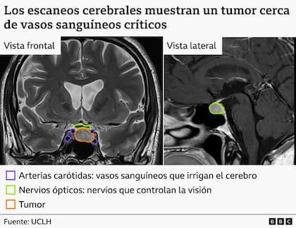 Los escaneos cerebrales