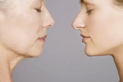 Los especialistas explican que para lograr determinados resultados es necesario realizar una cirugía facial