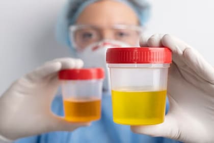 Los exámenes de orina pueden resultar un gran indicador para saber nuestro nivel de hidratación