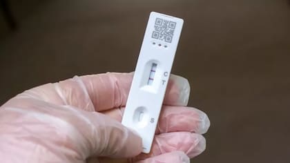 Los expertos advierten que un resultado negativo temprano no siempre descarta una infección, especialmente durante los primeros días de síntomas