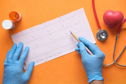 Los frutos secos ayudan a fortalecer el sistema cardiovascular