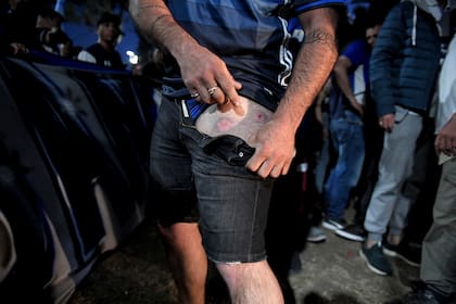 Los hinchas de Gimnasia mostraron las secuelas de una noche de desborde policial, en la puerta del estadio del Lobo.