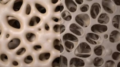 Los huesos se tornan más frágiles con la llegada de la menopausia