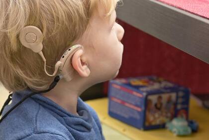 Los implantes cocleares son un ejemplo de dispositivos que están colocados muy cerca del cerebro.