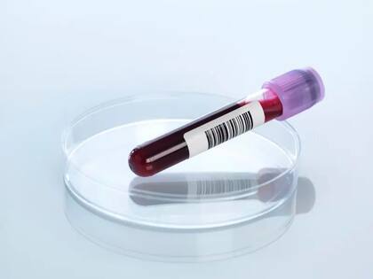 Los investigadores analizaron muestras de sangre de Branyas (foto genérica)