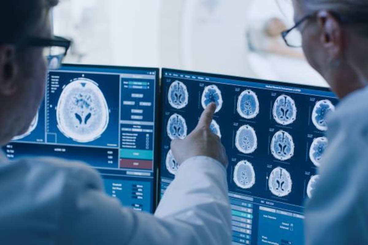 Los investigadores de IA y medicina estiman que se podría calcular qué le puede pasar a la salud de la población si se incrementa la obesidad en un 5%