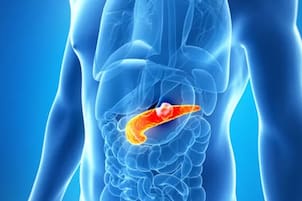 El desafío que enfrenta uno de los tratamientos más prometedores contra el cáncer