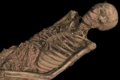 Los investigadores pudieron ver músculos y esqueleto, detrás del vendaje