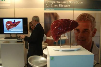 La hepatitis es la octava causa de muerte en el mundo