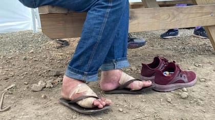 Los migrantes llegan con los pies heridos a los puestos de atención en el Darién por las largas caminatas