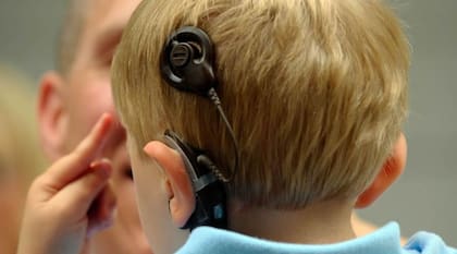 Los niños prematuros pueden enfrentarse a discapacidades, principalmente auditivas y visuales