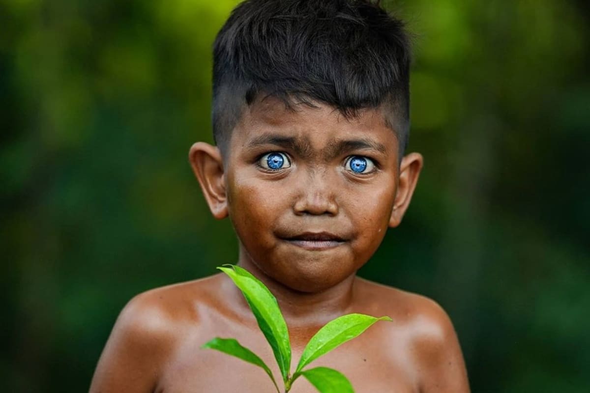 Los ojos brillantes color azul turquesa son causados por una mutación hereditaria