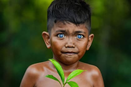 Los ojos brillantes color azul turquesa son causados por una mutación hereditaria