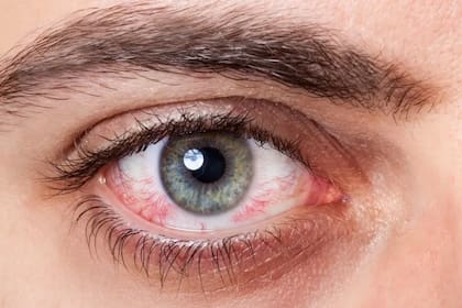 Los ojos se irritan por la exposición a la pantalla