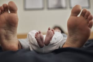 Los pacientes con el Síndrome de Alicia el País de las Maravillas pueden experimentar hasta 40 tipos de distorsiones visuales