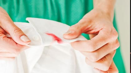 Los pasos previos antes de utilizar un método casero para quitar las manchas de desteñido de la ropa