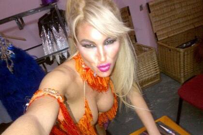 Los problemas capilares de Vicky, un secreto revelado