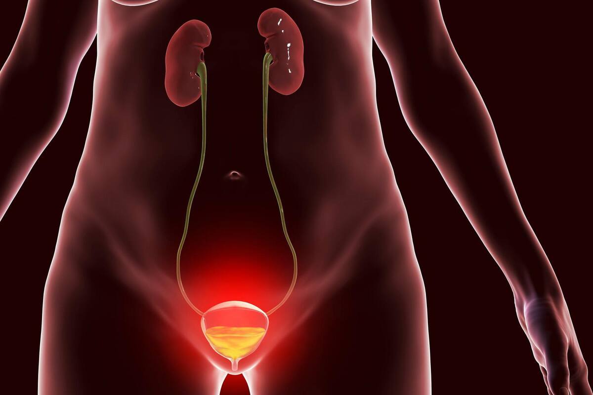 Los problemas de vejiga que presentan los jóvenes por el uso crónico de ketamina no son acordes con la edad.