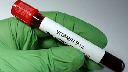 Los problemas de visión están relacionados a la falta de vitamina B12