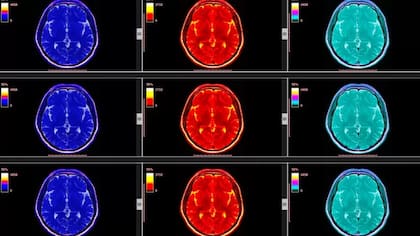 Los puntos del cerebro que generan placer utilizan ciertos neuroquímicos naturales como opioides o versiones naturales de la heroína o la marihuana para estimular el cerebro y generar esos placeres intensos según Berridge