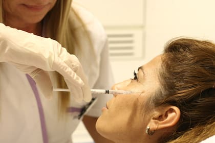 Los rellenos faciales podrían no ser inocuos